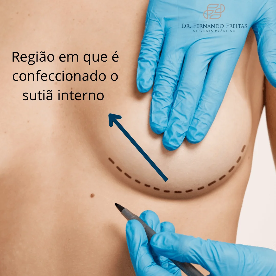 sutia-interno
