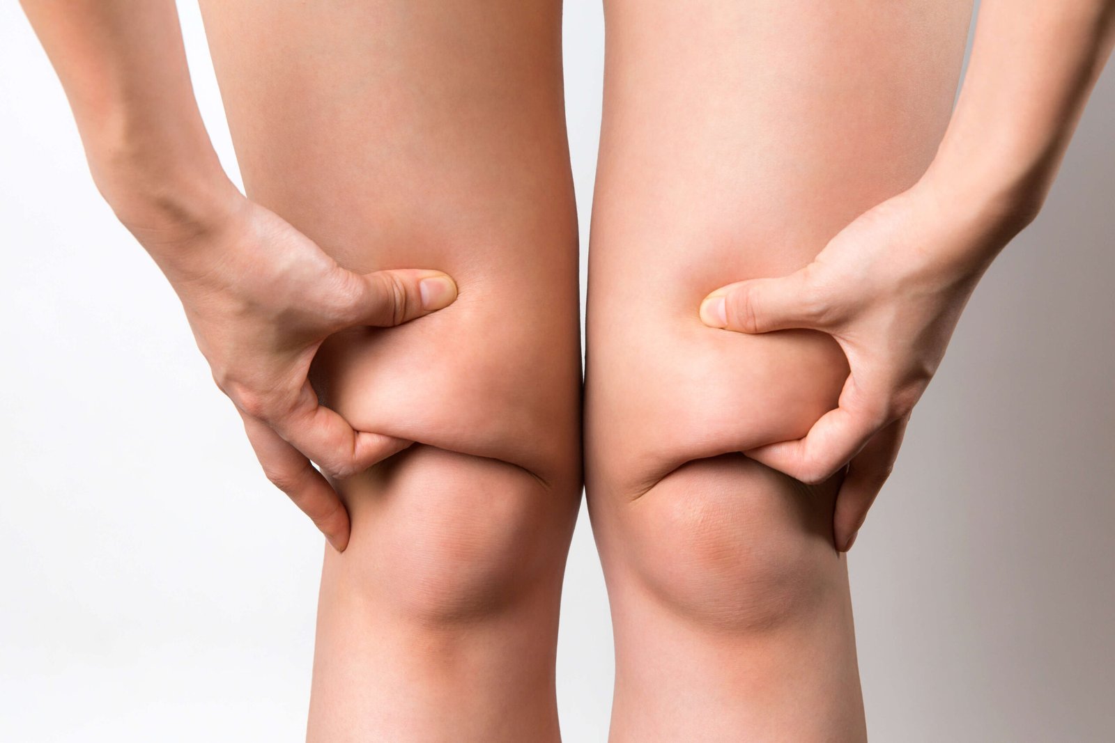 Lipedema: O Que É, Sintomas, Causas e Tratamento (Guia 2026)