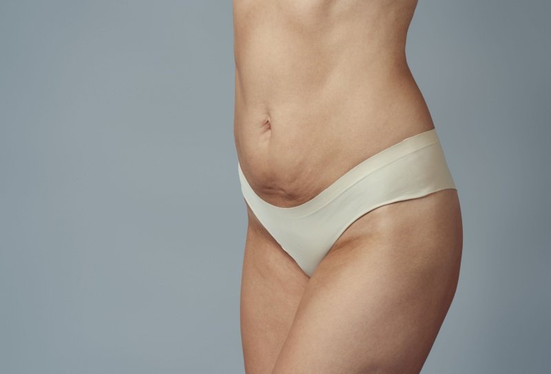 Tratamentos para flacidez na barriga