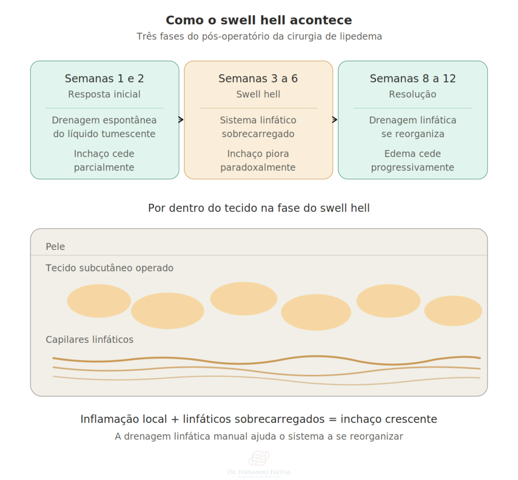 Diagrama do mecanismo do swell hell mostrando as três fases do pós-operatório da cirurgia de lipedema e os linfáticos sobrecarregados