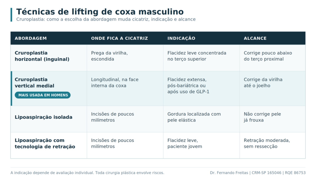 Tabela comparativa lifting de coxa masculina